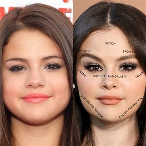 selena gomez boobs before and after|Selena Gomez: Before and After